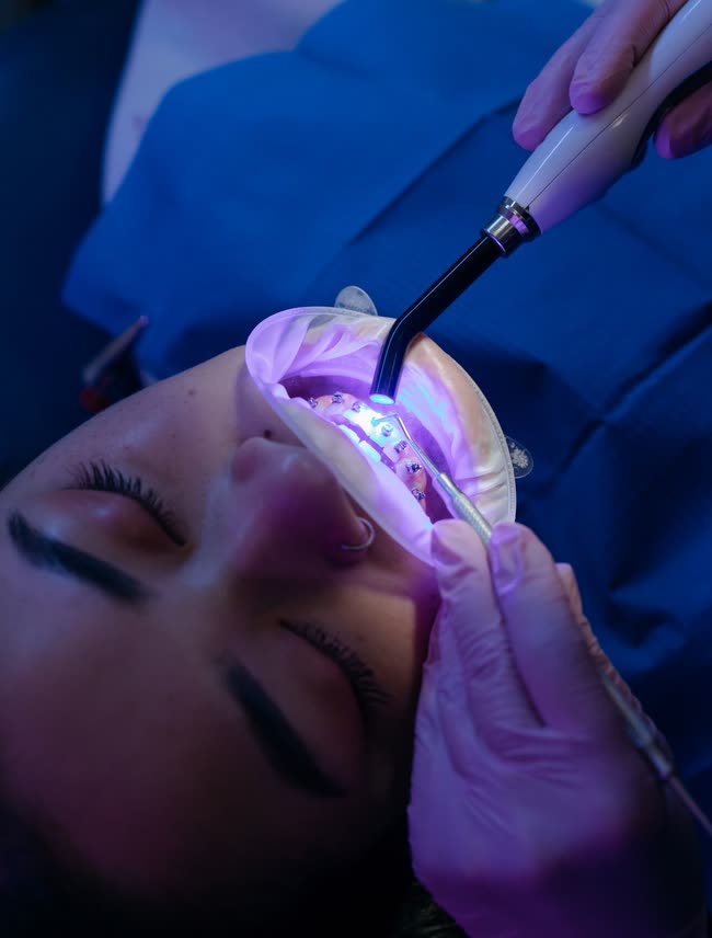 Smile makeover