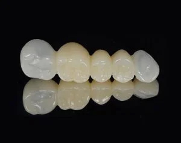 Tooth Crowns Materials