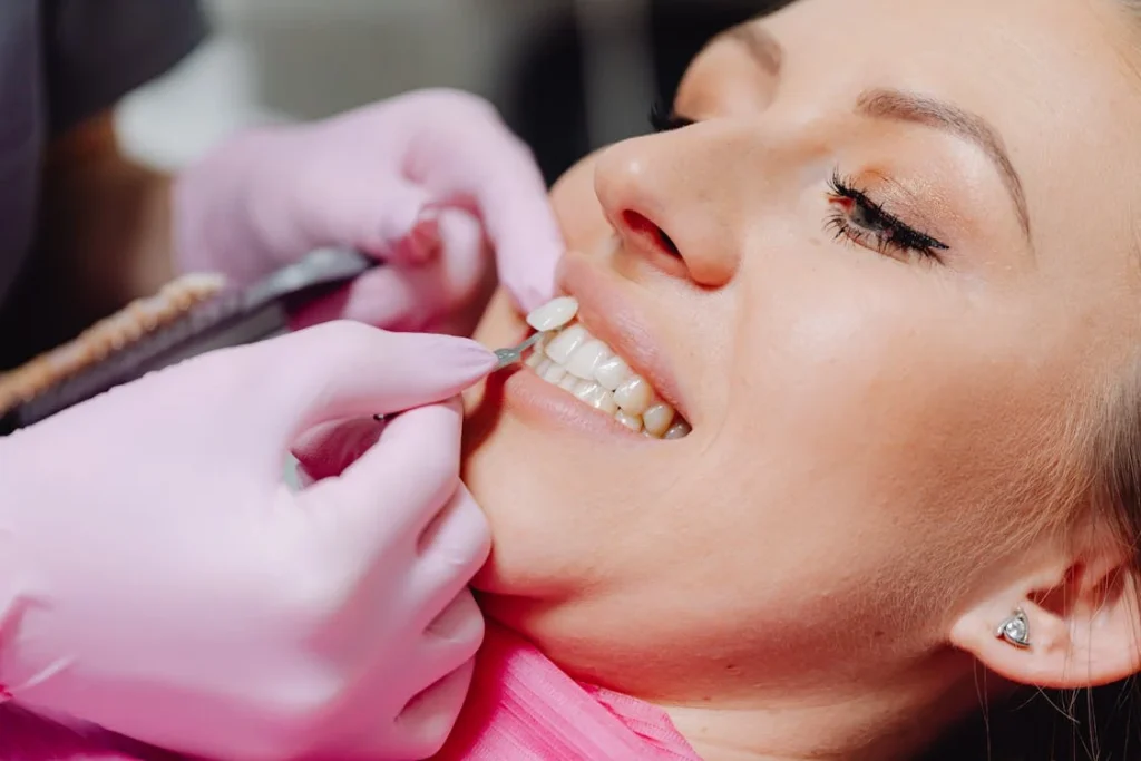 Veneers Over Crowns